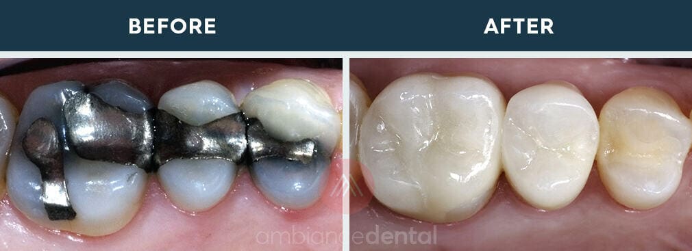 ambiance-dental-before-after-25